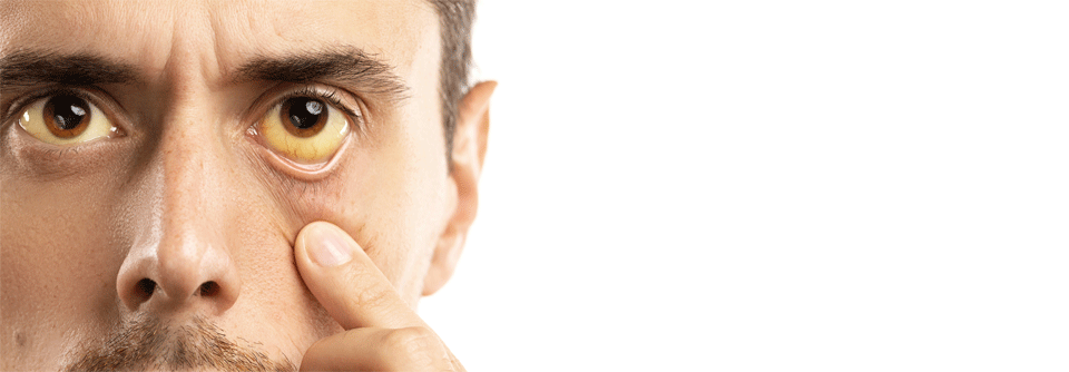 Etwa eine Million Menschen leiden in Deutschland unter einer Hepatitis-Infektion.