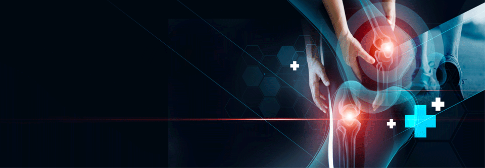 Eine schwedische Studie zeigt, dass Rauchen die Gelenke zerstören kann.