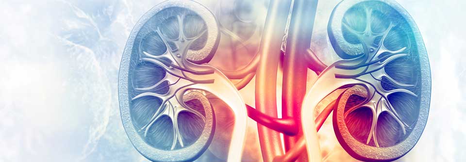 Bei der renalen Denervierung (RDN) wird ein Katheter von der Leiste aus über die Bauchschlagader in die Nierenarterien vorgeschoben.