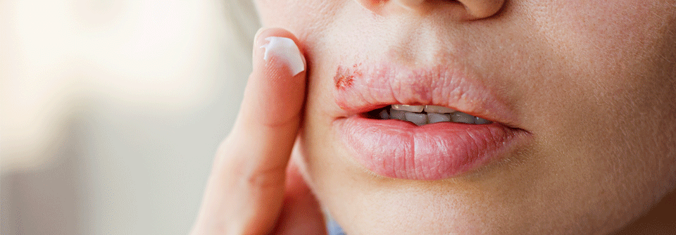 In den ersten Stunden nach der Infektion entscheidet sich in jeder befallenen Zelle, ob sich das Virus darin aktiv vermehrt oder in den Ruhezustand übergeht.