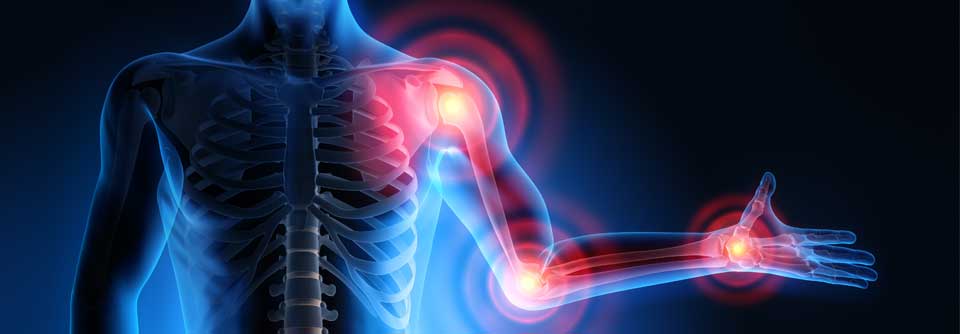 Untersucht worden war die Wirksamkeit von 4 Analgetikakombinationen.