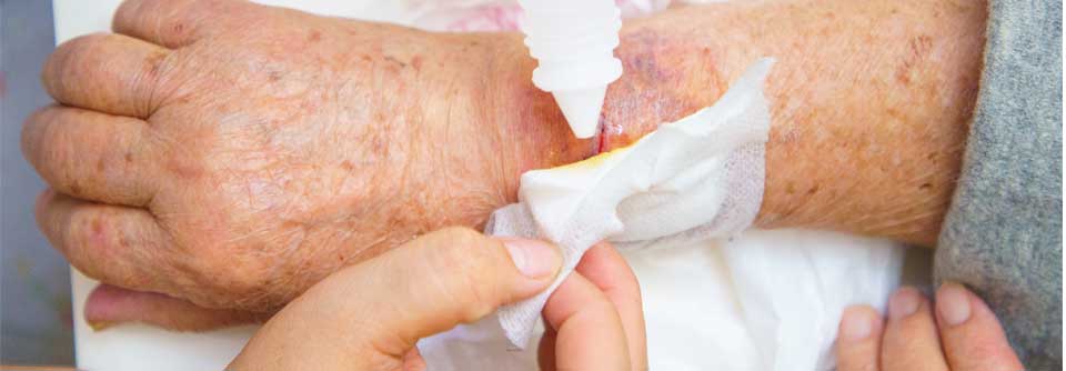 Warnhinweis: Vorsicht bei Wundspülung Die Spülung tiefer Wunden mit Octenisept® ist mit dem Risiko schwerer toxischer Gewebeschäden verbunden.