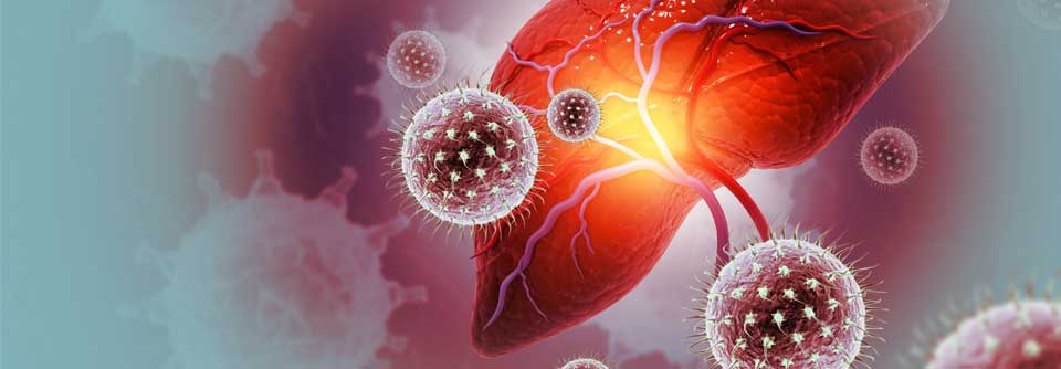  Von einer „akuten HCV-Infektion“ spricht man in den ersten 6 Monate nach der Infektion. 