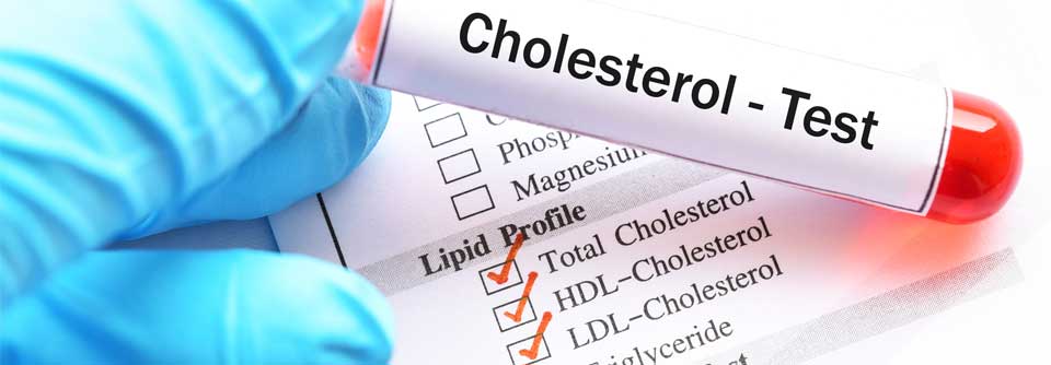 Der Body-Mass-Index sollte nicht als Basis für die Durchführung eines Lipidprofils bei einem individuellen Patienten dienen.