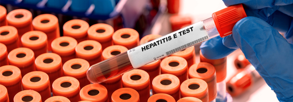 Forschungen zu Hepatitis E untersuchen neue Übertragungswege und Ansätze zur Impfprävention.