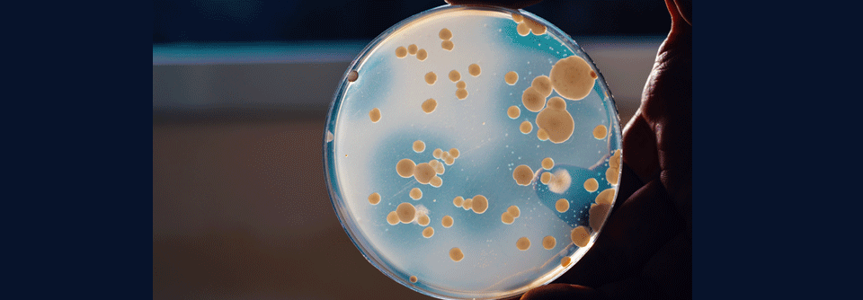 Leberkrebs: Mikrobiomanalysen von Leberproben liefern neue Erkenntnisse Eine Analyse bestätigt beim HCC eine Mikrobiom-Dysbiose, die potenziell therapeutisch nutzbar sein könnte.