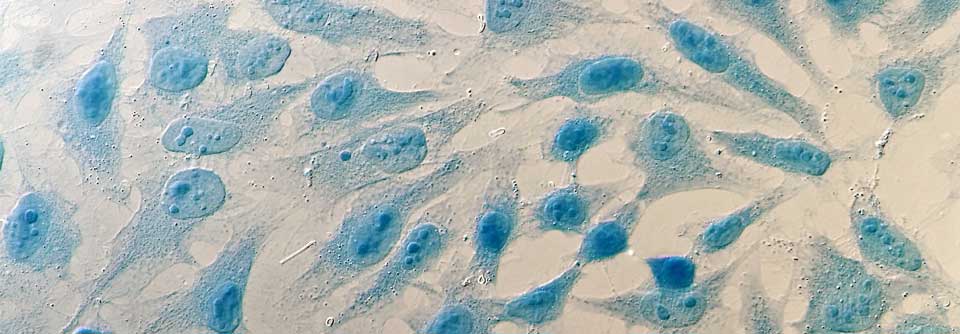 HeLa-Zellen haben Millionen Menschen das Leben gerettet – doch niemand kennt die Frau, von der sie stammen: Henrietta Lacks.