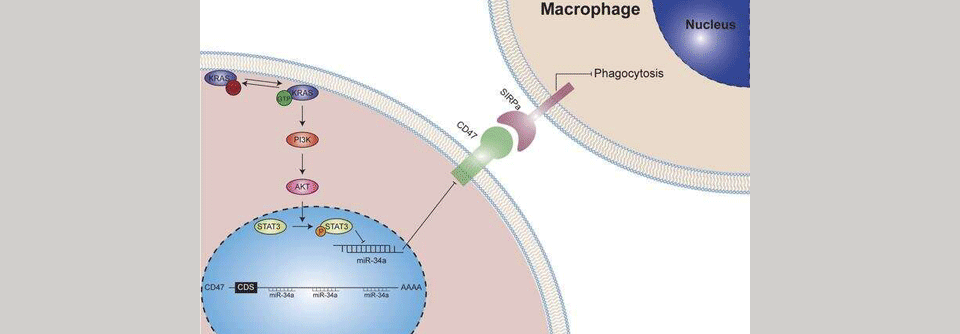 Die KRAS-Mutation fördert das Tumorwachstum bei Lungenkrebs, indem sie dem Tumor das Entkommen vor der Immunüberwachung ermöglicht.