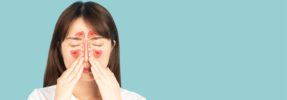 In der Erstlinienbehandlung einer chronischen Rhinosinusitis mit Nasenpolypen kommen intranasale Kortikosteroide zum Einsatz.