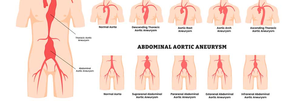 Patienten haben bereits jetzt die Möglichkeit, den Ultraschall-Check für rund 25 Euro auf eigene Kosten vornehmen zu lassen.