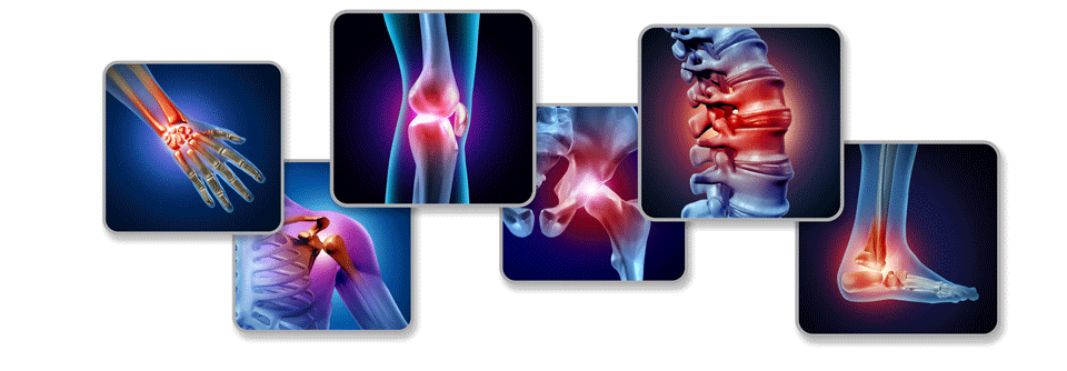 EU-Zulassung für Ixekizumab bei juveniler idiopathischer Arthritis Die Europäische Kommission hat die Zulassung für den IL-17A-Inhibitor Ixekizumab (Taltz®) zur Behandlung der aktiven juvenilen Psoriasis-Arthritis (JPsA) erteilt