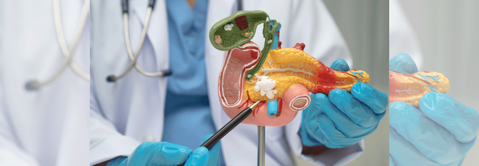 Pankreaskrebs: OP-Verfahren beeinflusst Prognose nicht Drei-Jahres-Daten der DIPLOMA-Studie zeigen, dass minimalinvasive Pankreatomien langfristig keine Nachteile bringen.