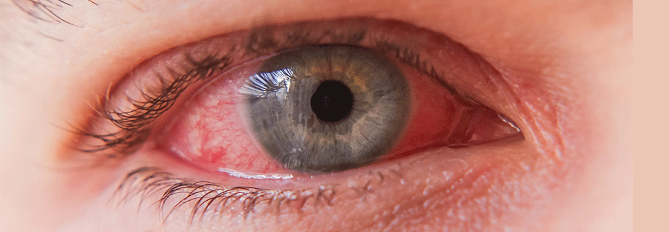 Viele Medikamente bedrohen unbemerkt die Augengesundheit 