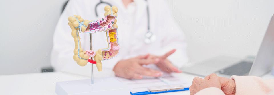 Die Konsultationsfassung der komplett überarbeiteten S3-Leitlinie Colitis ulcerosa wurde bereits verabschiedet, die Veröffentlichung der neuen Leitlinie wird erwartet.