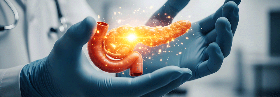 Menschen mit Typ-2-Diabetes haben ein zweifach erhöhtes Risiko für Bauchspeicheldrüsenkrebs.