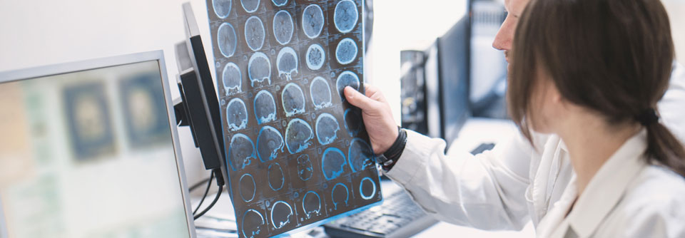 PERPRISE-Studie bestätigt den klinischen Nutzen von Perampanel bei Aktive Epilepsie und zeigt nach 12 Monaten eine Retentionsrate von 66,7%.