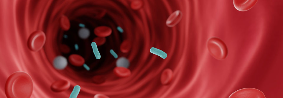 Jedes Jahr erkranken in Deutschland knapp 280.000 Menschen an einer Sepsis. 