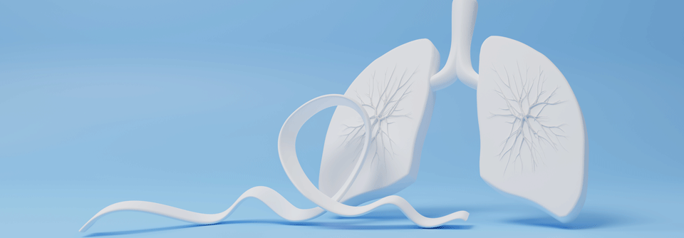 In den letzten 20 Jahren hat sich die Prognose für Patientinnen und Patienten mit chronisch thromboembolischer pulmonaler Hypertonie deutlich gebessert.