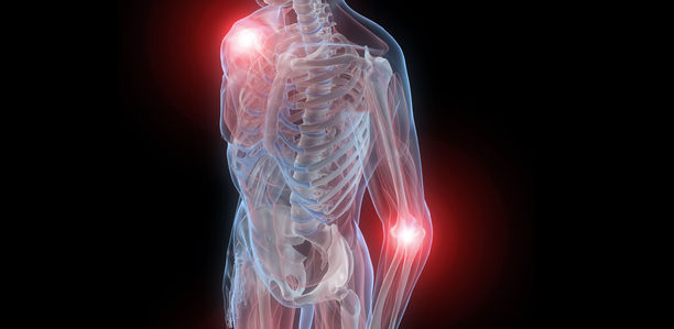 Rheumatologie: Auf Infektionsschutz achten