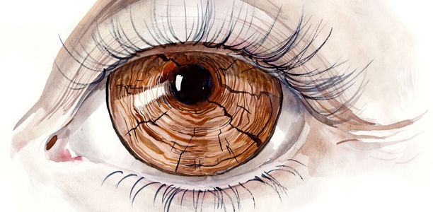 Das kranke Auge: Was ist im Alter häufig?
