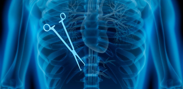 Behandlungs-Fehler: Blinder Fleck am Röntgenbild?