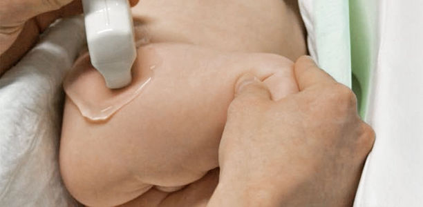 Die kranke SäuglingsHüfte: Bandage, Gips oder OP?