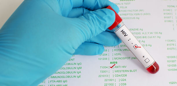 AIDS: Wichtige opportunistische Infektionen