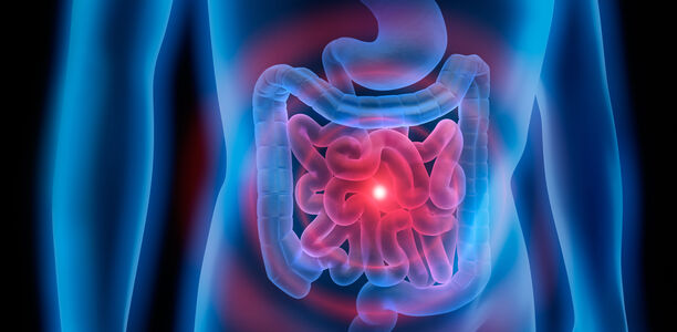 Gastroenterologie (4): Infektion mit Clostridium difficile