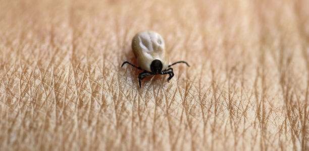 Borreliose und FSME: Serologie nach jedem Zeckenstich?