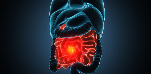 Morbus Crohn: Welche Laborkontrollen sind wichtig?