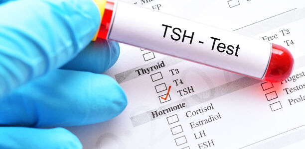 Hoher TSH-Wert: Thyroxin geben?