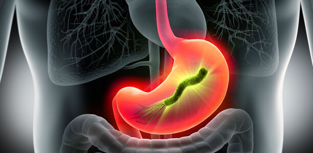 Helicobacter-pylori-Eradikation: Vorsicht mit der Standard-Tripeltherapie!