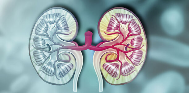 C3-Glomerulopathie: Komplementvermittelt und sehr selten