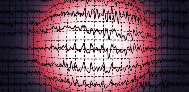 Neurologie: Parkinson kündigt sich im Schlaf an Wenn Menschen über 50 Jahren sogenannte REM-Schlaf-Verhaltensstörung haben und keine anderen Ursachen dafür vorliegen, wie zum Beispiel Drogenkonsum, bekommen sie mit einer Wahrscheinlichkeit von über 80 % in den nächsten Jahren Parkinson
