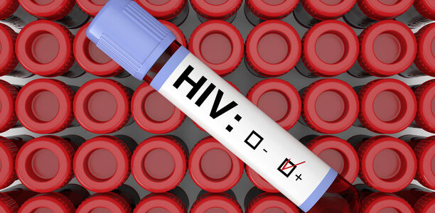 AIDS: Weniger HIV-Infektionen Wahrscheinlich hat die COVID-19-Pandemie durch verschiedene Faktoren zum Rückgang der HIV-Neudiagnosen im Jahr 2020 beigetragen.