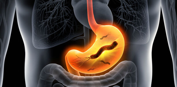 Helicobacter pylori: Auch ohne Symptome behandeln!