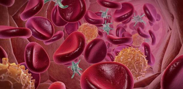 Pathologisches Blutbild: Was ist selten – was ist häufig?