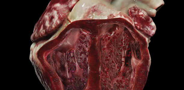 Weiterbildung: Hyperrealistisch und präzise „Insight Heart“, „Insight Lung“ und „Insight Kidney“ sind in der Lage, Krankheitszustände und ihre Auswirkungen auf das jeweilige Organ noch besser zu visualisieren.
