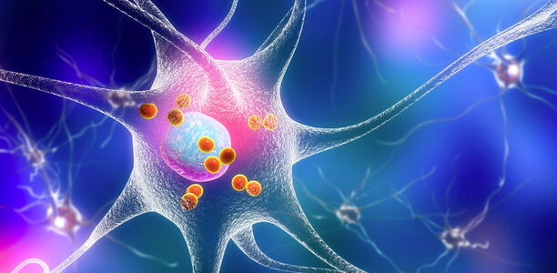 Parkinson: Bald Bluttest für Parkinson & Co? Krankhafte Formen des Proteins α-Synuclein im Blut von Patient:innen lassen sich zur Diagnose der Parkinson-Krankheit nutzen.