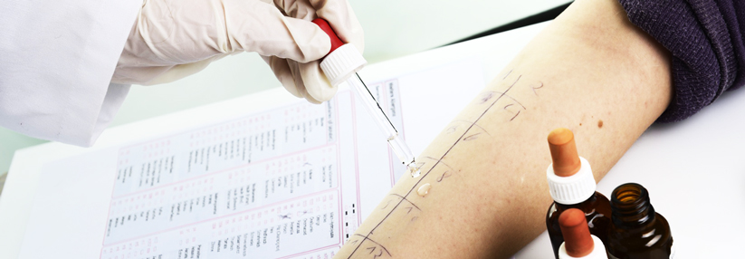Bei begründetem Verdacht auf eine Penicillinallergie ist die standardisierte Hauttestung die Untersuchung der Wahl.