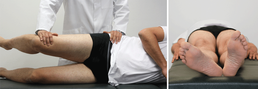 Hüftschmerzen: Sehnen ins Visier nehmen! Beim Testen der Abduktion in Seitenlage ist die korrekte Position des Beckens wichtig: Eine zu große Kippung nach ventral kann das Ergebnis verfälschen, da der M. gluteus maximus dann bei der Bewegung mithilft (Abb. links). Eine spontane vermehrte Außenrotation des Beins kann durch eine Schwäche des M. gluteus medius bedingt sein (Abb. rechts).