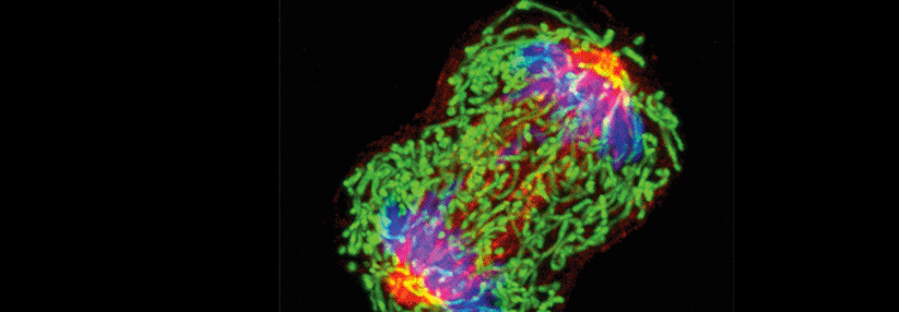 Sind Tumorsuppressoren wie BRCA1 aufgrund einer Mutation nicht funktionsfähig, teilt sich die Zelle auch dann weiter, wenn DNA-Schäden vorliegen.