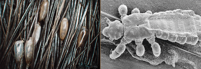 Nach der Behandlung wird man damit auch Nissen (die weißen Eihüllen links im Bild) los. Mit einem Rasterelektronenmikroskop kann man auch die seitlichen Atemöffnungen erkennen (rechts).