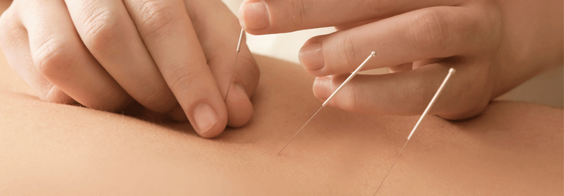 Akupunktur bessert Lebensqualität und Symptome.
