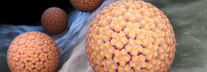 Schon mit reduzierter Strahlendosis können HPV-positive Plattenepithelkarzinome  behandelt werden.