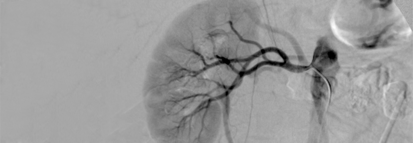 Jodhaltige Kontrastmittel sind wasserlöslich und werden renal ausgeschieden. Deshalb eignen sie sich zur Darstellung der Nieren, Harnwege, Venen und Arterien.