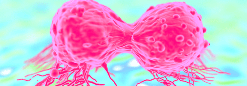 Eine Brustkrebszelle hält sich nicht an die Regeln. Sie ist riesengroß, polyploid und kann in umliegende Gewebe invadieren.