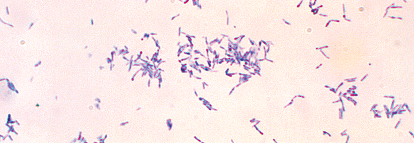 Die kleine Schwester der Diphtherie: Corynebacterium ulcerans wird von Haustieren übertragen C. ulcerans verbreitet sich auch bei uns, z.B. über Hunde, Katzen und Rinder.