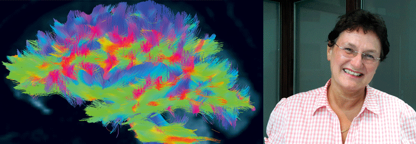 So sieht mein Gehirn in der Diffusions-Tensor-Bildgebung aus. Dabei misst man die Bewegungen von Wassermolekülen im Gewebe. Daraus lässt sich ableiten, wo die Nervenbahnen verlaufen. Die Farben zeigen die jeweilige Richtung an (rechts:Dr. Anja Braunwarth, Ärztin und Medizinjournalistin) 
