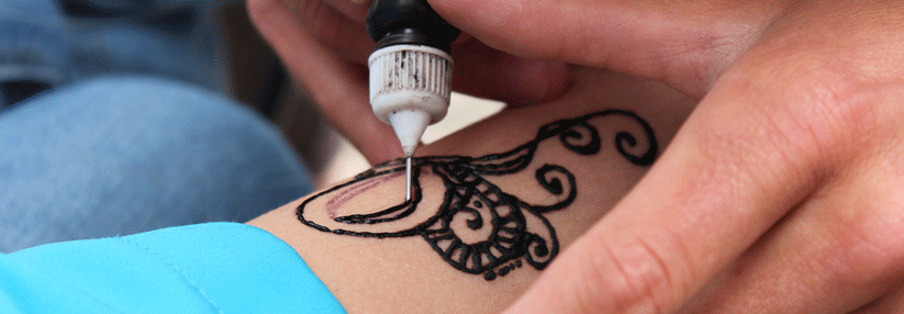 Temporäre „Black Henna“-Tattoos können permanente Folgen haben: Manch einer, der allergisch auf den Farbstoff PDD reagiert, behält Narben.